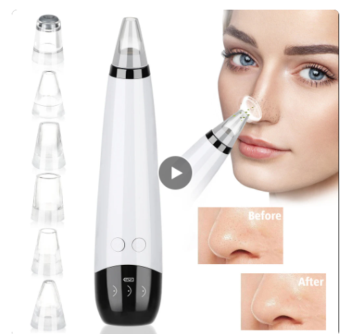 Rechargeable Blackhead Remover: Electric Facial Pore Cleaner